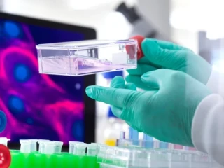 Terapi Sel Punca Buka Harapan Baru Pengobatan Diabetes