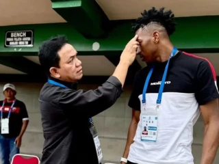 Tangisan Haru Bos Madura United! Jorge Mendonca Mulai Pulih dari Retak Tengkorak